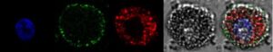 Confocal Microscopy of ARPE-19 Cell Expression of Stimulated by Retinoic Acid 6 (STRA6)