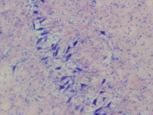 Neurons in the human medial superior olive