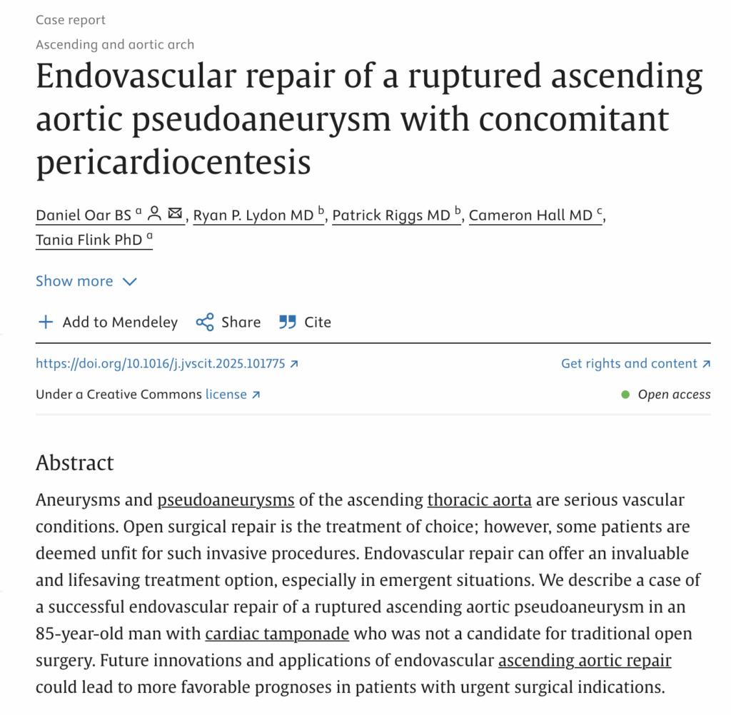 Endovascular repair of a ruptured ascending aortic pseudoaneurysm with concomitant pericardiocentesis.