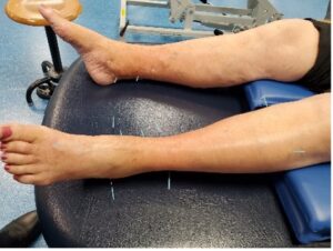 Picture of human legs